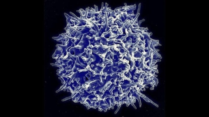 ‘Tüm kanserleri tedavi edebilen’ hücre: T hücresi
