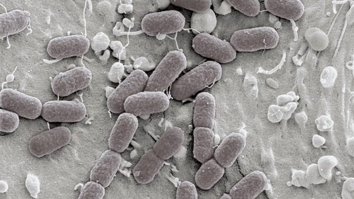 Yapay zeka sayesinde en tehlikeli bakterileri öldüren antibiyotik bulundu